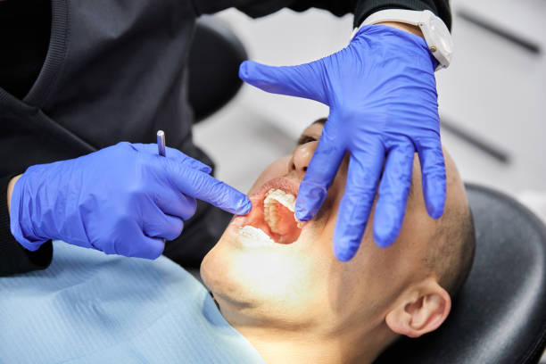 Best Root Canal Emergency Dentist  in Chain Lake, WA